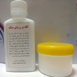 عکس لکه بر اثر زردی سنگ چسب 123 نانوشاین  21998